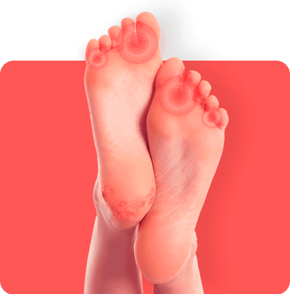 Последствия от нелекувани гъбички