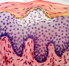 Exodermin Komplex Hatás