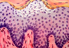 Exodermin Komplex Hatás